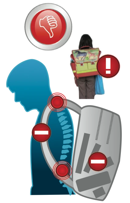 Réglage incorrect du sac à dos